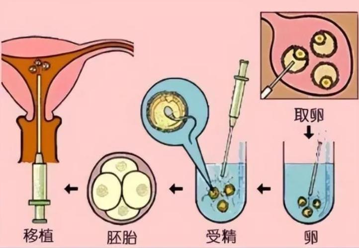 供卵试管宝宝老是出汗什么原因